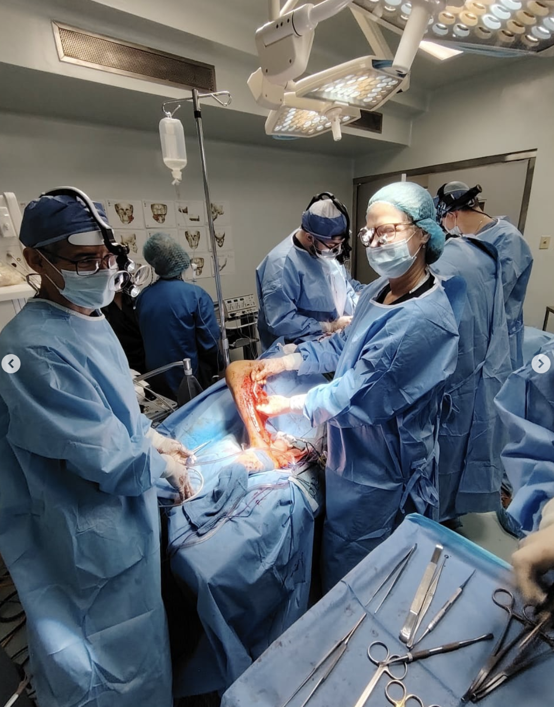 Post-op reconstruction