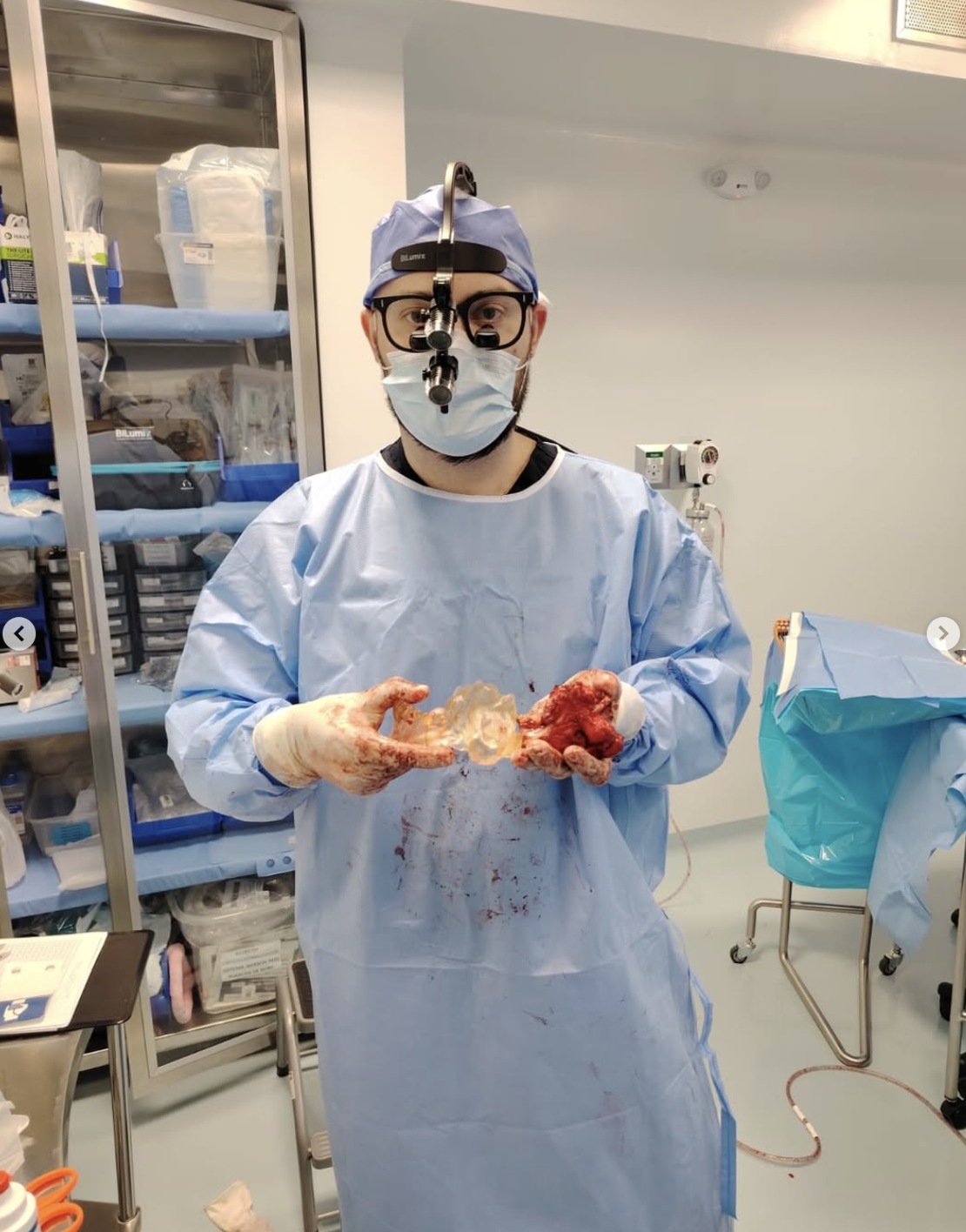 25 Year Old With Skull Base Tumor